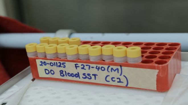 अस्ट्रेलियामा कोरोनाभाइरस विरूध्दका दुई खोपकाे परीक्षण शुरु